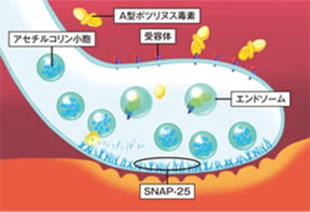 神経筋接合部におけるA型ボツリヌス毒素の作用部位の図