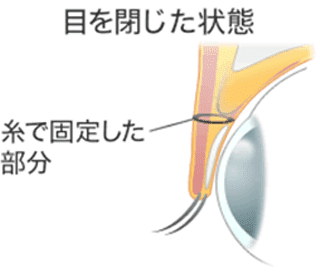 目を閉じた状態