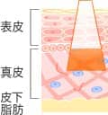 表皮・真皮・皮下脂肪