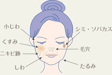 小じわ・くすみ・ニキビ跡・しわ・シミ・ソバカス・毛穴・たるみ