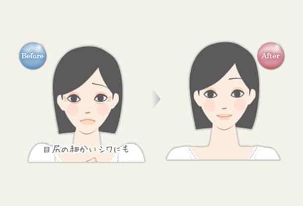 目もと ヒアルロン酸注入の図