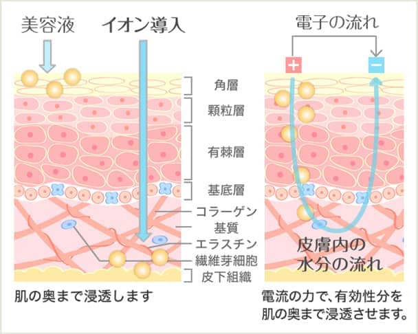 イオン導入の効果の図