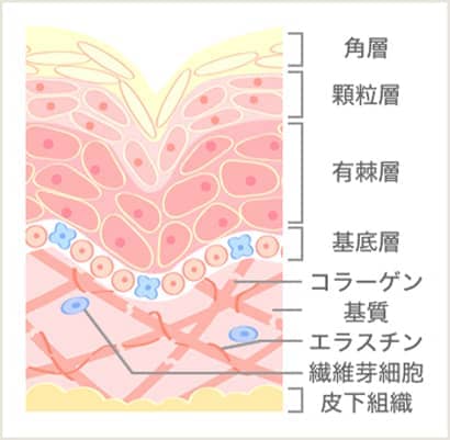 イオン導入前の図