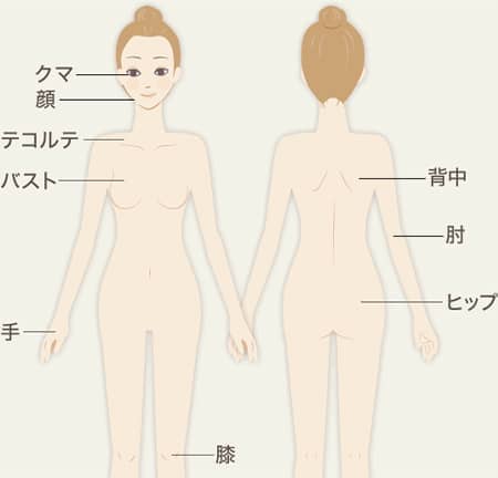 イオン導入の施術可能箇所の図