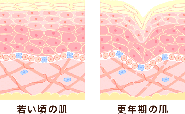 若い頃の肌 更年期の肌