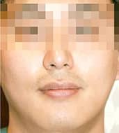 症例写真 before