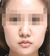 症例写真 before