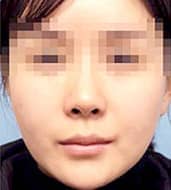 症例写真 before