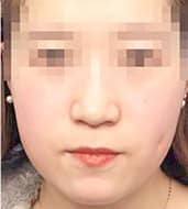 症例写真 before