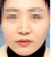 症例写真 before