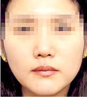 症例写真 before