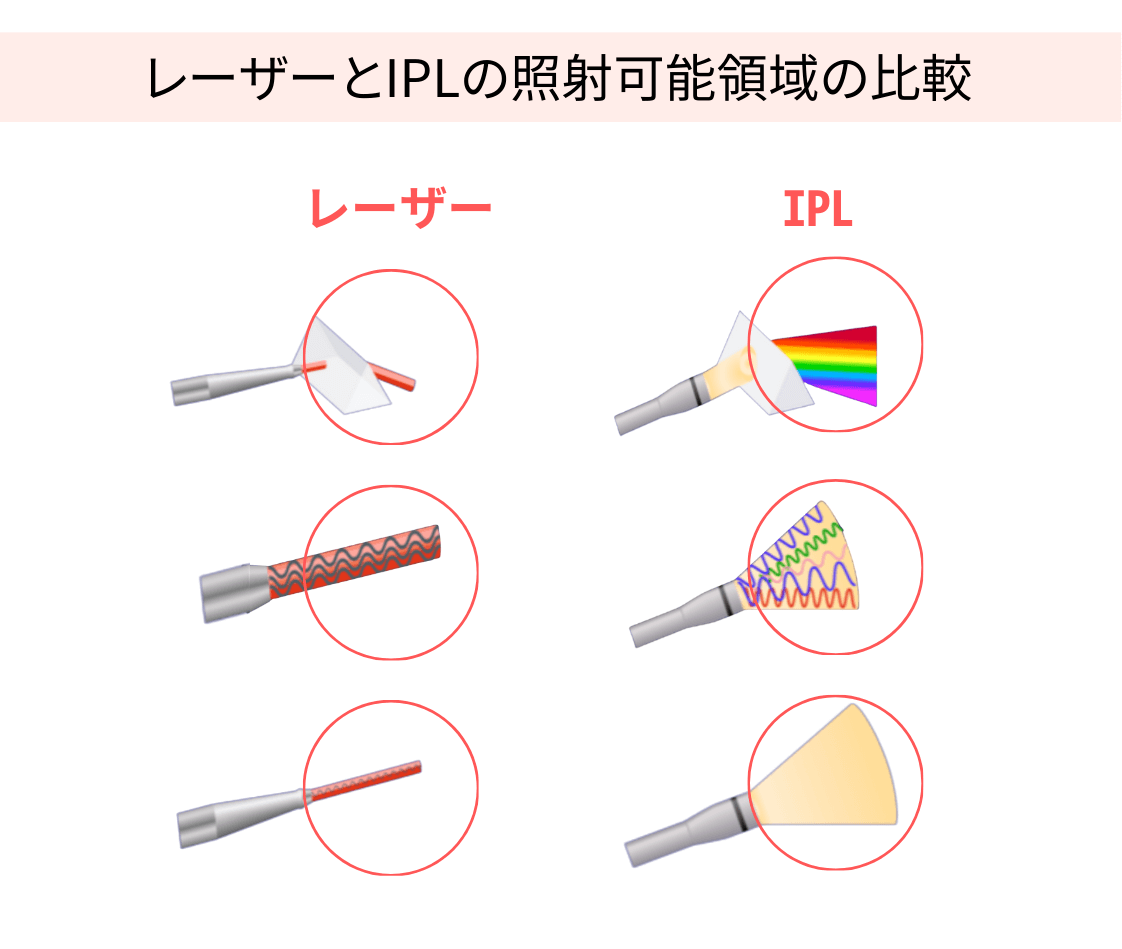 施術について