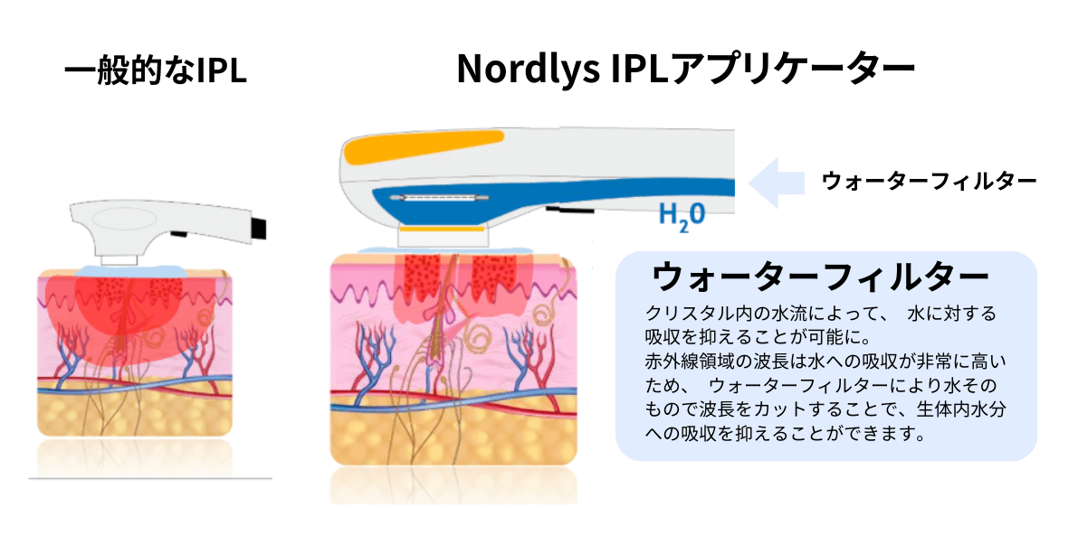 施術について