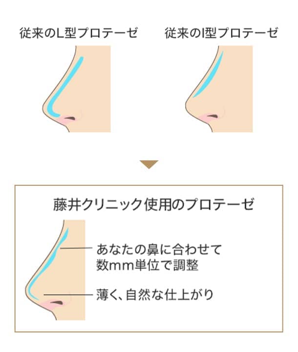 藤井クリニック使用のプロテーゼの図