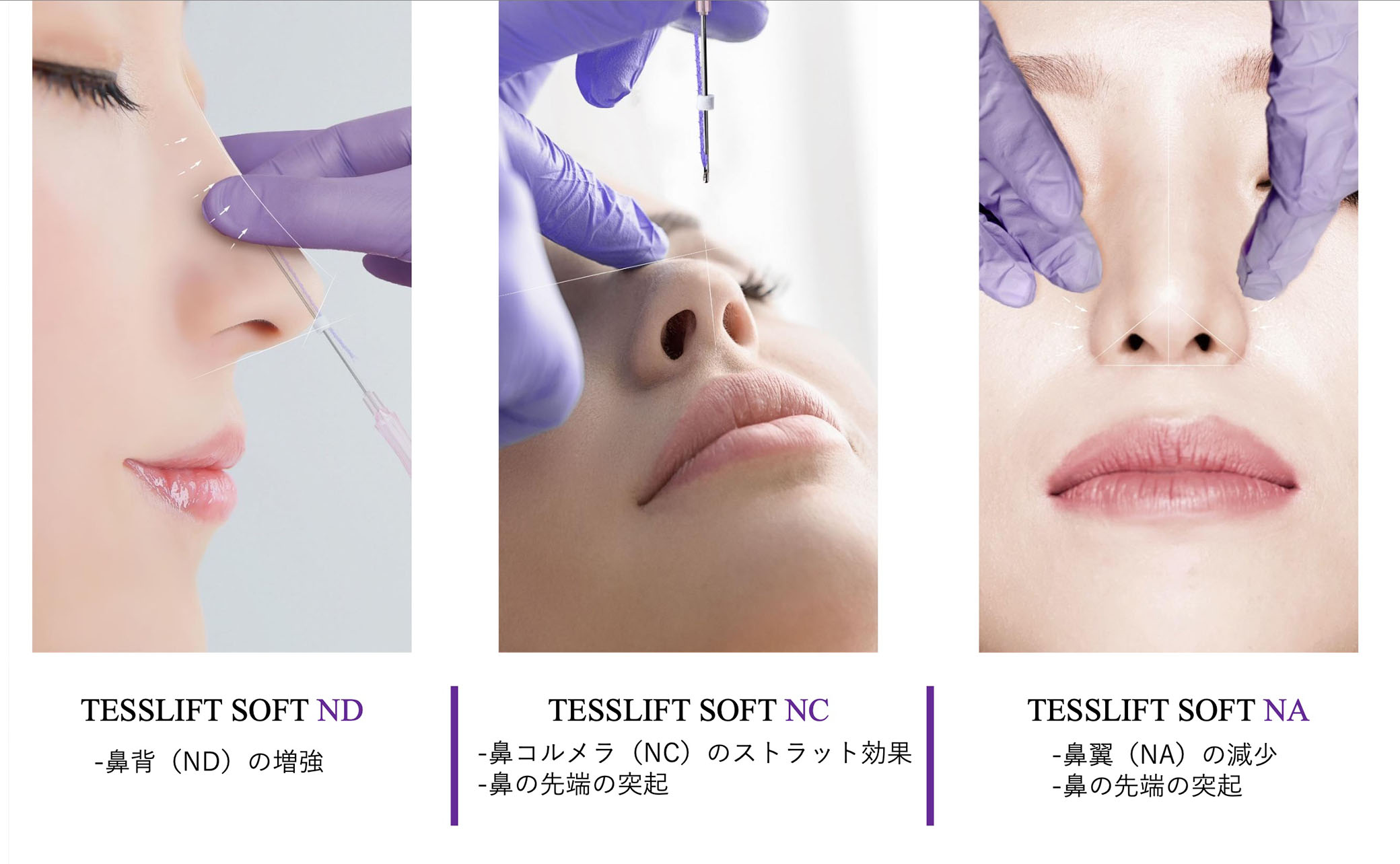 TESSLIFT SOFT NOSE SERIES