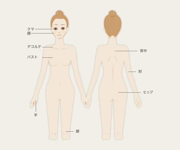 ケミカルピーリングの施術可能箇所の図