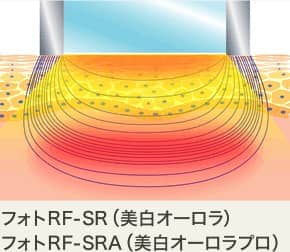 フォトRF-SR（美白オーロラ）・フォトRF-SRA（美白オーロラプロ）