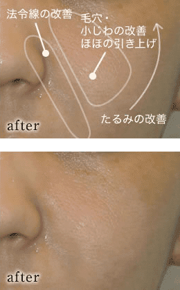 after