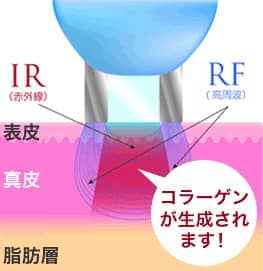 コラーゲンが生成されます！