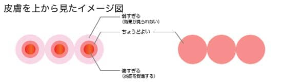 皮膚を上から見たイメージ図