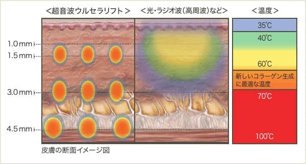 熱の伝わり方のグラフ