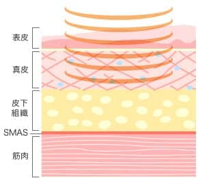 表皮・真皮・皮下脂肪・SMAS・筋肉