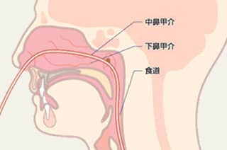 中鼻甲介・下鼻甲介・食道