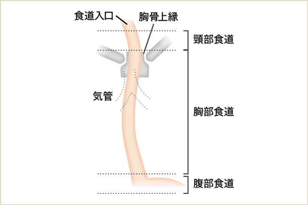 食道の病気イメージ画像