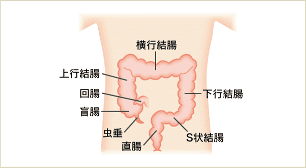 大腸の病気イメージ画像