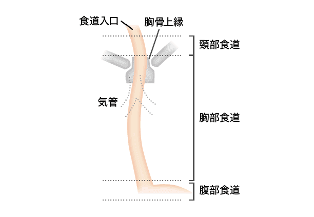 食道の病気・十二指腸の病気