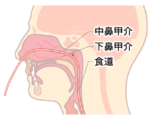 食道の病気・十二指腸の病気