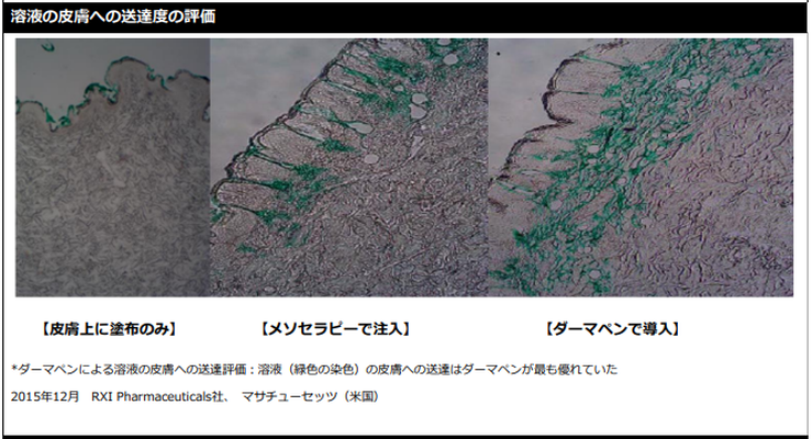 溶液の皮膚への送達度の評価