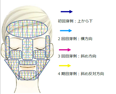 治療の手順