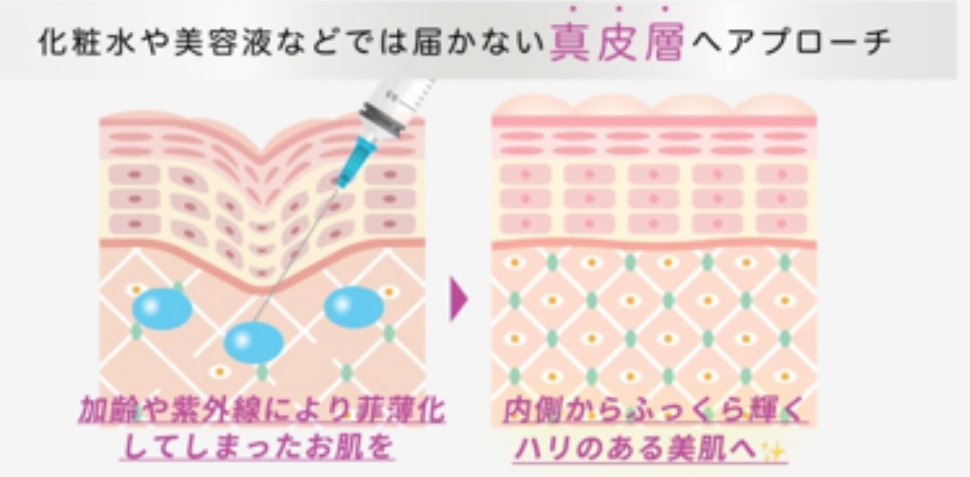 治療の仕組み