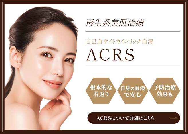 ACRSの詳細はこちら