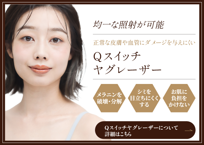 Qスイッチヤグレーザーの詳細はこちら