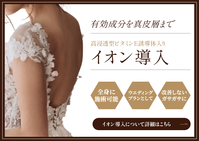 イオン導入の詳細はこちら