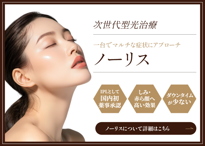 ノーリスの詳細はこちら