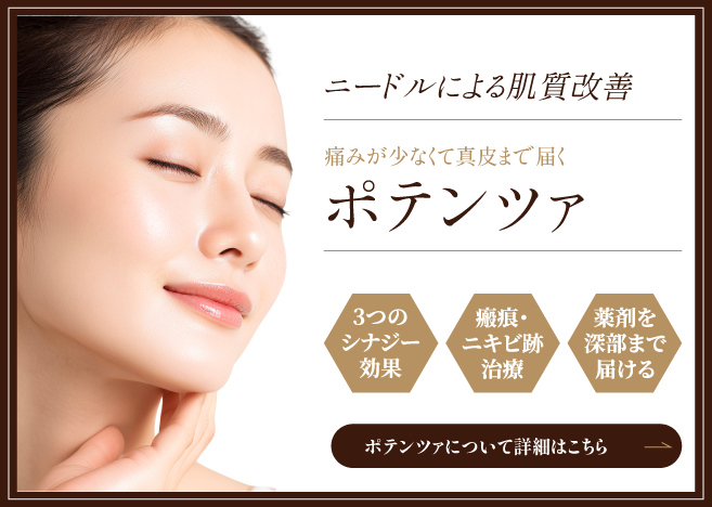 ポテンツァの詳細はこちら